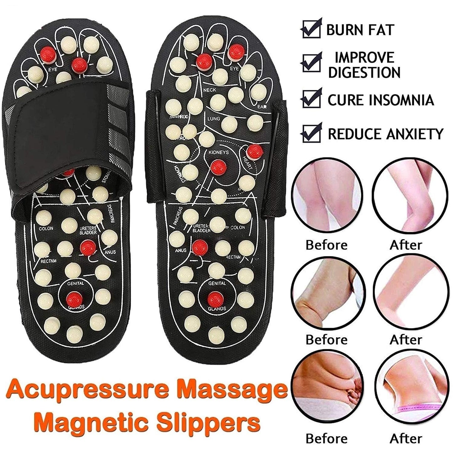 Acupressure and Magnetic Therapy Slippers |š„FLAT 50% OFF SALEš„